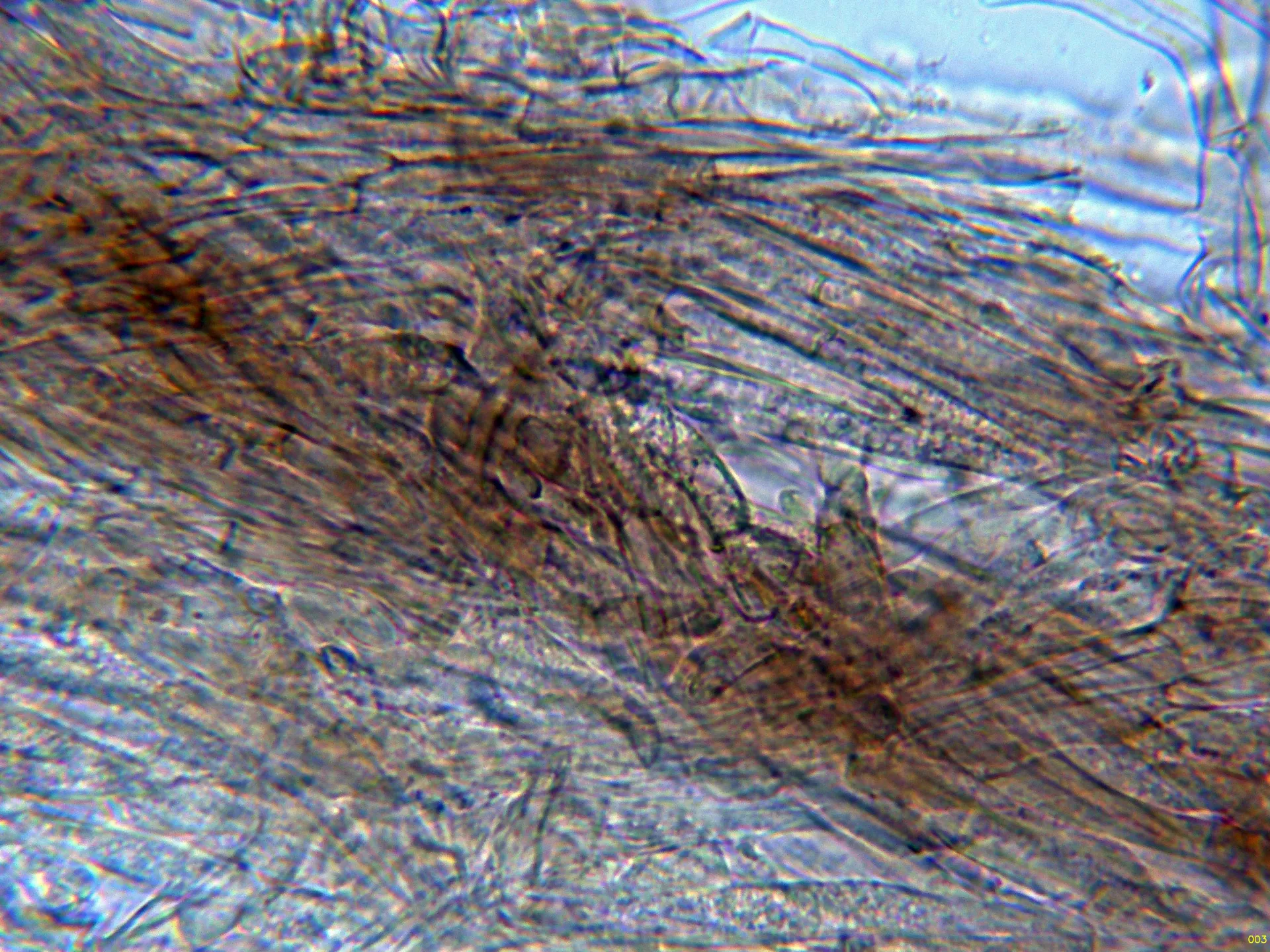 Microscopía de Tricholoma colossus - 6 - Suprapellis agua-003